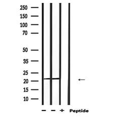 Invitrogen PRDX2 Polyclonal Antibody 100 &mu;L; Unconjugated:Antibodies,