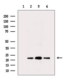 Invitrogen PRDX2 Polyclonal Antibody 100 &mu;L; Unconjugated:Antibodies,
