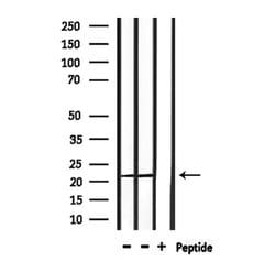Invitrogen PRDX2 Polyclonal Antibody 100 &mu;L; Unconjugated:Antibodies,