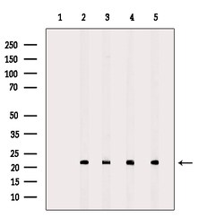 Invitrogen PRDX2 Polyclonal Antibody 100 &mu;L; Unconjugated:Antibodies,