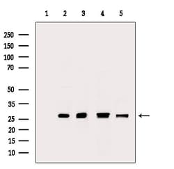 Invitrogen PRDX2 Polyclonal Antibody 100 &mu;L; Unconjugated:Antibodies,