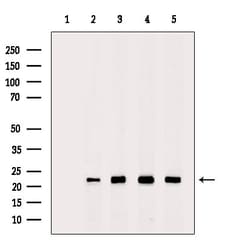 Invitrogen PRDX2 Polyclonal Antibody 100 &mu;L; Unconjugated:Antibodies,