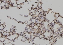 Invitrogen DLC1 Polyclonal Antibody 100 &mu;L; Unconjugated:Antibodies,