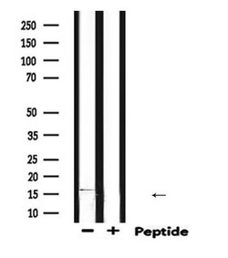 Invitrogen DLC1 Polyclonal Antibody 100 &mu;L; Unconjugated:Antibodies,