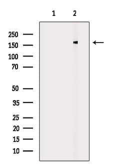 Invitrogen DLC1 Polyclonal Antibody 100 &mu;L; Unconjugated:Antibodies,
