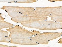 Invitrogen PRL3 Polyclonal Antibody 100 &mu;L; Unconjugated:Antibodies,