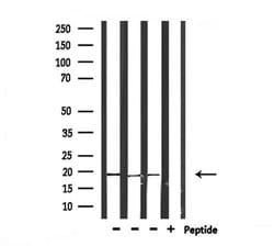 Invitrogen PRL3 Polyclonal Antibody 100 &mu;L; Unconjugated:Antibodies,