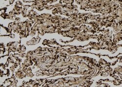 Invitrogen DST Polyclonal Antibody 100 μL; Unconjugated:Antibodies,