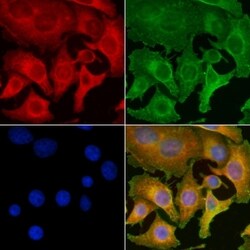 CDKN3 Polyclonal Antibody:Antibodies, Polyclonal