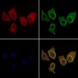 CDKN3 Polyclonal Antibody:Antibodies, Polyclonal