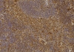 CDKN3 Polyclonal Antibody:Antibodies, Polyclonal