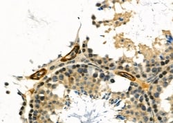 CDKN3 Polyclonal Antibody:Antibodies, Polyclonal