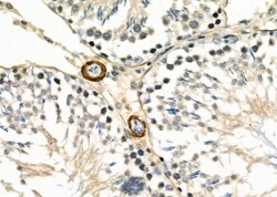 CDKN3 Polyclonal Antibody:Antibodies, Polyclonal