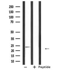 CDKN3 Polyclonal Antibody:Antibodies, Polyclonal