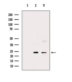CDKN3 Polyclonal Antibody:Antibodies, Polyclonal