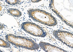 Invitrogen IGF2 Polyclonal Antibody 100 &mu;L; Unconjugated:Antibodies,