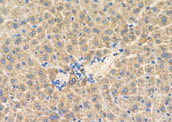 Invitrogen IGF2 Polyclonal Antibody 100 &mu;L; Unconjugated:Antibodies,