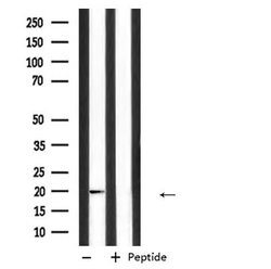 Invitrogen IGF2 Polyclonal Antibody 100 &mu;L; Unconjugated:Antibodies,