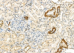 Invitrogen E-selectin Polyclonal Antibody 100 &mu;L; Unconjugated:Antibodies,