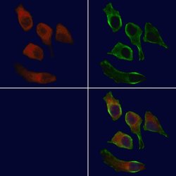 Invitrogen E-selectin Polyclonal Antibody 100 &mu;L; Unconjugated:Antibodies,