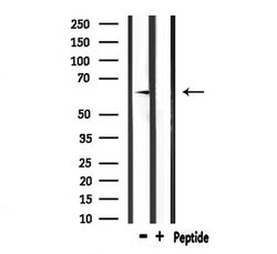 Invitrogen E-selectin Polyclonal Antibody 100 &mu;L; Unconjugated:Antibodies,