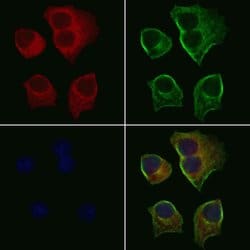 Invitrogen P2Y6 Polyclonal Antibody 100 &mu;L; Unconjugated:Antibodies,