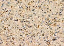 Invitrogen P2Y6 Polyclonal Antibody 100 &mu;L; Unconjugated:Antibodies,