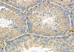 Invitrogen P2Y6 Polyclonal Antibody 100 &mu;L; Unconjugated:Antibodies,