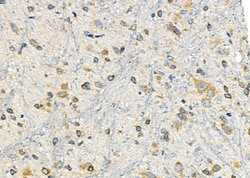 Invitrogen P2Y6 Polyclonal Antibody 100 &mu;L; Unconjugated:Antibodies,