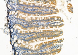 Invitrogen P2Y6 Polyclonal Antibody 100 &mu;L; Unconjugated:Antibodies,