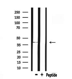 Invitrogen ACP5 Polyclonal Antibody 100 &mu;L; Unconjugated:Antibodies,