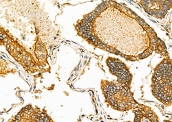Invitrogen ACP5 Polyclonal Antibody 100 &mu;L; Unconjugated:Antibodies,