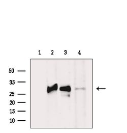 Invitrogen CD16 Polyclonal Antibody 100 &mu;L; Unconjugated:Antibodies,