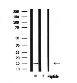 KISS1 Polyclonal Antibody:Antibodies, Polyclonal
