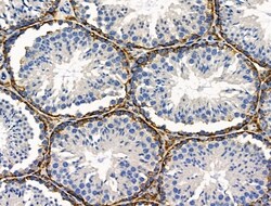 Invitrogen PDX1 Polyclonal Antibody 100 &mu;L; Unconjugated:Antibodies,