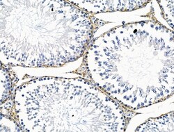 Invitrogen PDX1 Polyclonal Antibody 100 &mu;L; Unconjugated:Antibodies,