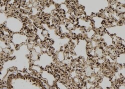 Invitrogen PDX1 Polyclonal Antibody 100 &mu;L; Unconjugated:Antibodies,