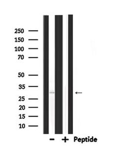 Invitrogen PDX1 Polyclonal Antibody 100 &mu;L; Unconjugated:Antibodies,