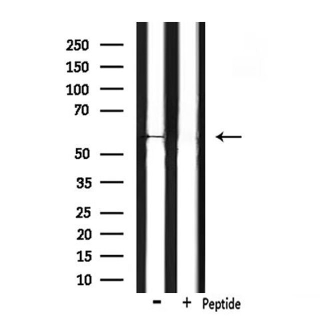 Invitrogen CHRM5 Polyclonal Antibody 100 μL | Buy Online | Invitrogen ...