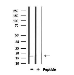 Invitrogen NDUFA13 Polyclonal Antibody 100 μL; Unconjugated:Antibodies,