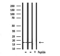 Invitrogen NDUFA13 Polyclonal Antibody 100 μL; Unconjugated:Antibodies,