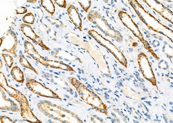 Invitrogen GARS Polyclonal Antibody 100 &mu;L; Unconjugated:Antibodies,