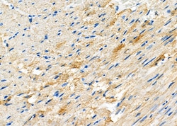 Invitrogen GARS Polyclonal Antibody 100 &mu;L; Unconjugated:Antibodies,