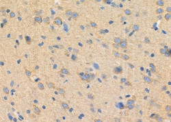 Invitrogen GARS Polyclonal Antibody 100 &mu;L; Unconjugated:Antibodies,