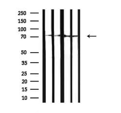 Invitrogen GARS Polyclonal Antibody 100 &mu;L; Unconjugated:Antibodies,