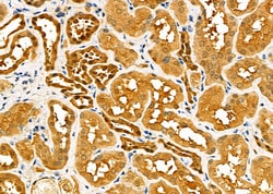 Invitrogen CBR1 Polyclonal Antibody 100 &mu;L; Unconjugated:Antibodies,