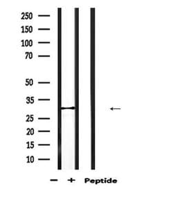 Invitrogen CBR1 Polyclonal Antibody 100 &mu;L; Unconjugated:Antibodies,