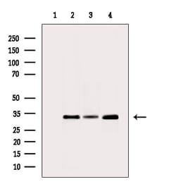 Invitrogen CBR1 Polyclonal Antibody 100 &mu;L; Unconjugated:Antibodies,
