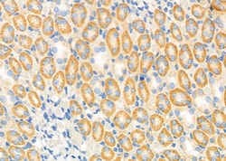 Invitrogen ATIC Polyclonal Antibody 100 &mu;L; Unconjugated:Antibodies,