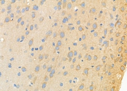 Invitrogen ATIC Polyclonal Antibody 100 &mu;L; Unconjugated:Antibodies,